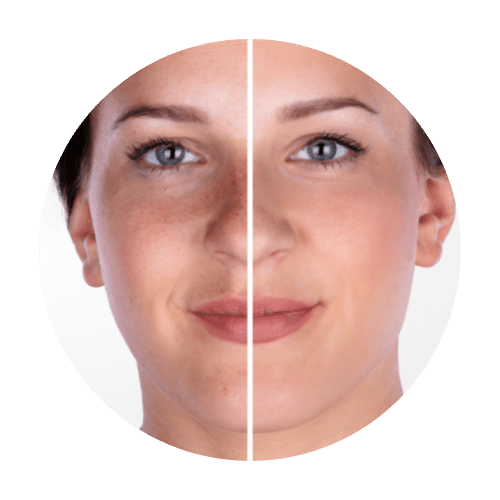 Microdermabrasion Kosmetikstudio